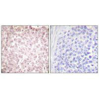 RCC1 Antibody