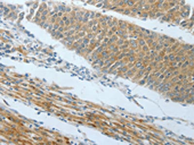 AMPH Antibody