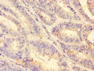 MMP2 Antibody