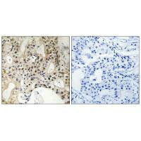 LATS1/LATS2 Antibody