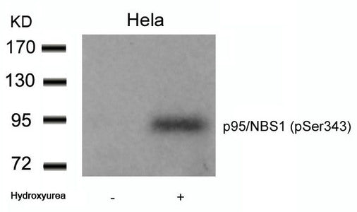 Phospho-NBN (Ser343) Antibody