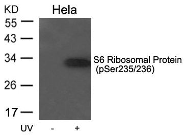 Phospho-RPS6 (Ser235/236) Antibody