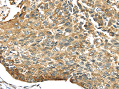TRIM16 Antibody