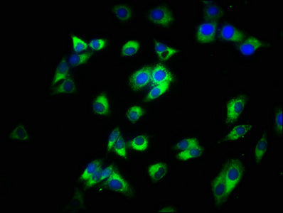 CD14 Antibody