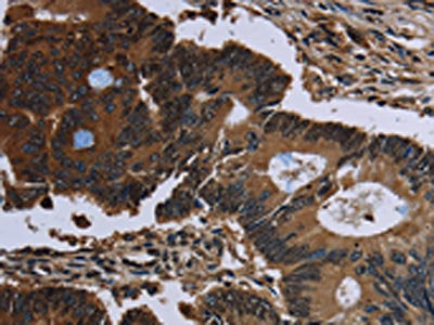 IRGM Antibody