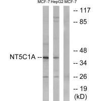 NT5C1A Antibody