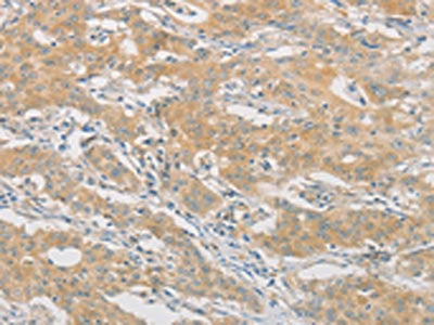 HIPK4 Antibody