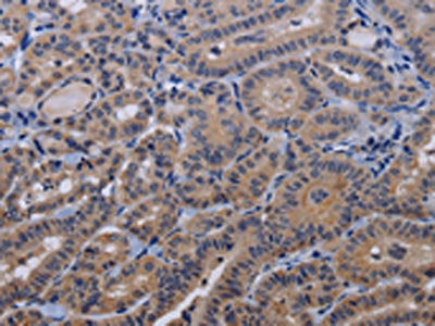 TRPM8 Antibody