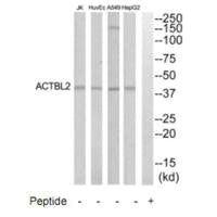 ACTBL2 Antibody