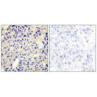 COL5A2 Antibody