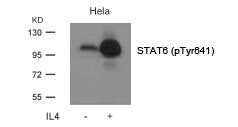 Phospho-STAT6 (Tyr641) Antibody