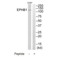 EPHB1 Antibody