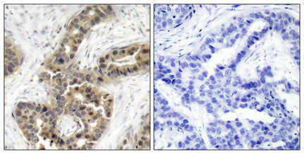 Phospho-CDKN1A (Thr145) Antibody