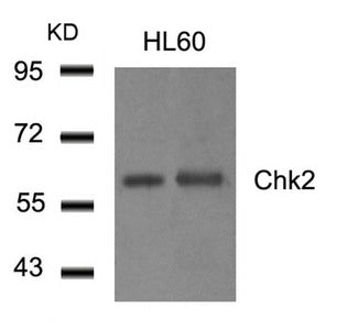 CHEK2 (Ab-516) Antibody