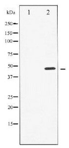 AFP Antibody