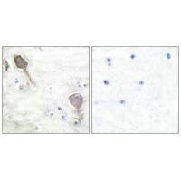 PARK2 Antibody