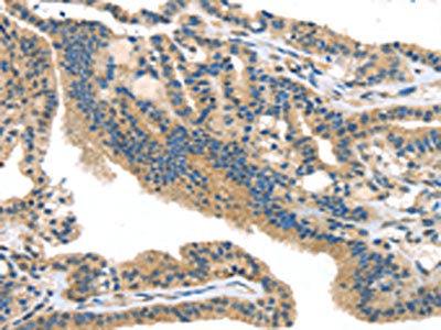 SMYD3 Antibody