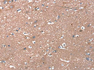 RHEB Antibody