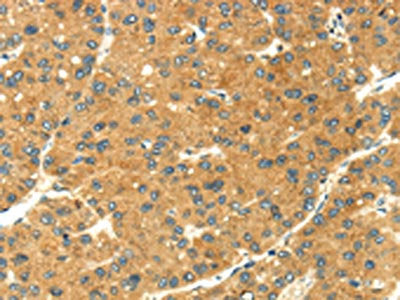 SEMA4C Antibody
