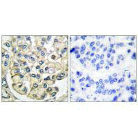 FGFR2 Antibody