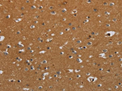 CSH1 Antibody