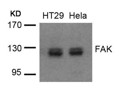 PTK2 (Ab-576/577) Antibody