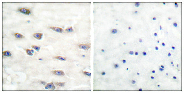 Phospho-NTRK1 (Tyr791) Antibody