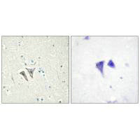 ACVR1C Antibody