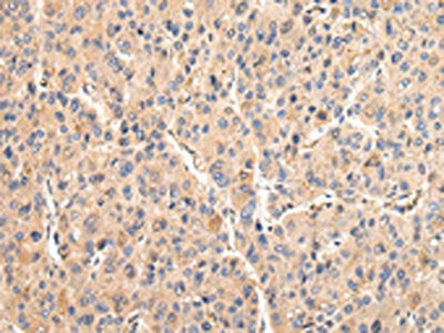 VCAM1 Antibody
