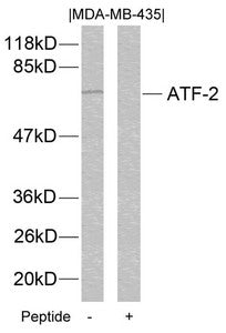 ATF2 (Ab-112 or 94) Antibody