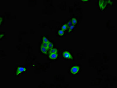 CD70 Antibody