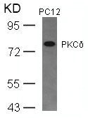 PRKCD (Ab-645) Antibody