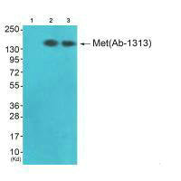 MET (Ab-1313) Antibody