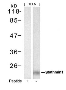 STMN1 (Ab-62) Antibody