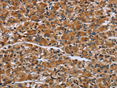 IL2RG Antibody