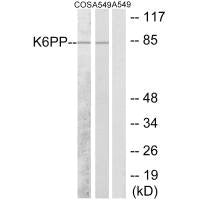 PFKP Antibody