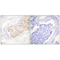 UBR5 Antibody