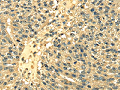 RPS3 Antibody