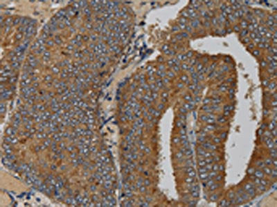 MAS1 Antibody