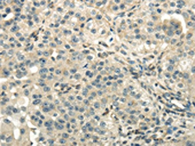 DLAT Antibody