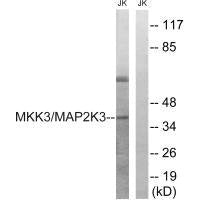 MAP2K3 (Ab-222) Antibody