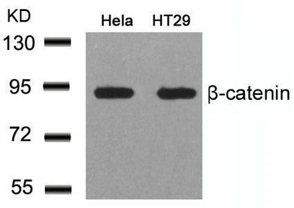 CTNNB1 (Ab-41/45) Antibody