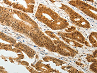 TWIST1 Antibody