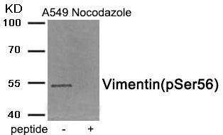 Phospho-VIM (Ser56) Antibody