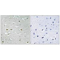 URB1 Antibody