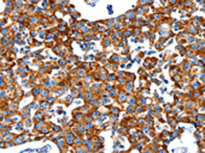 KLK2 Antibody