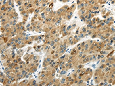 UGT2B4 Antibody