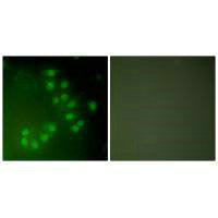 TP63 Antibody