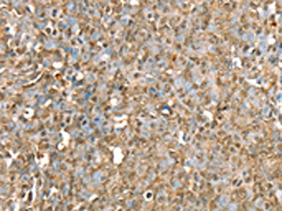 RBM5 Antibody