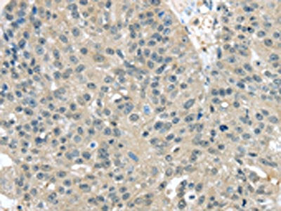 TXNDC17 Antibody